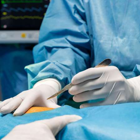 A cirurgia bariátrica é segura?